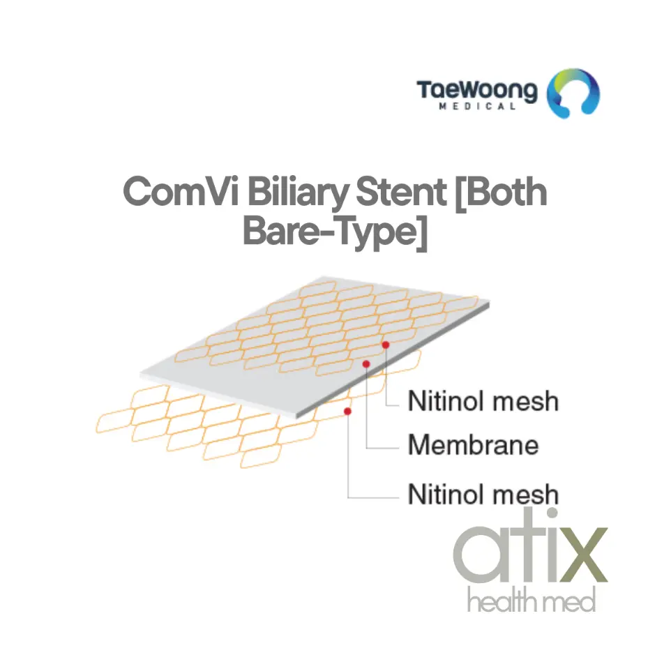 Stent Biliar COMVI diseñado para la estenosis biliar maligna stent biliar COMVI de tres capas está diseñado para la estenosis biliar maligna