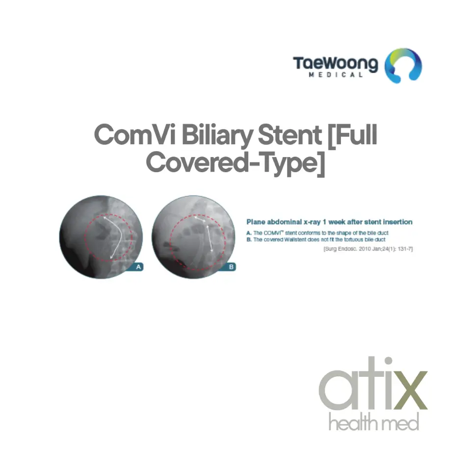 Stent Biliar ComVi End Bare-Type | Tratamiento de estenosis biliares malignas ComVi Biliary Stent End Bare-Type para estenosis biliares malignas