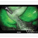 Stryker 32" 4K Surgical Monitor